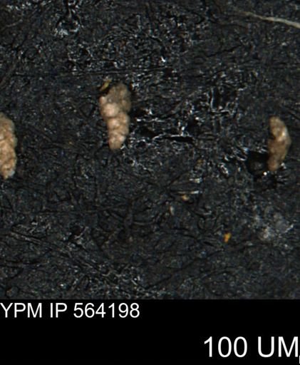Verneuilina canadensis