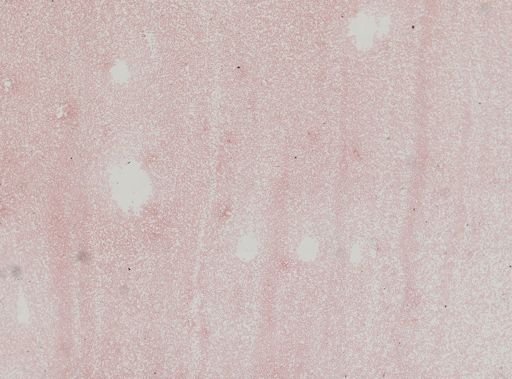 Plasmodium vivax