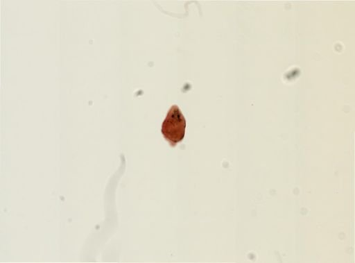 Plagiostomum morgani