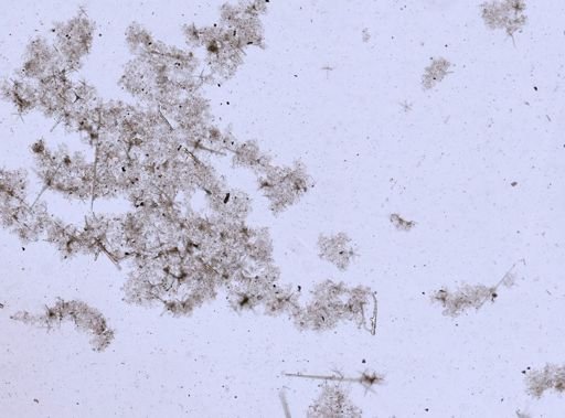 Hexactinellida