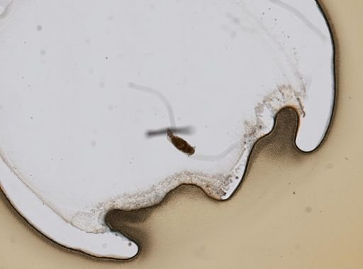 Notommata falcinella