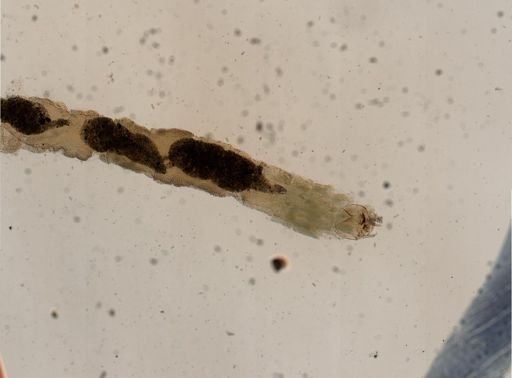 Tanytarsus