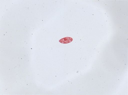 Paramecium aurelia