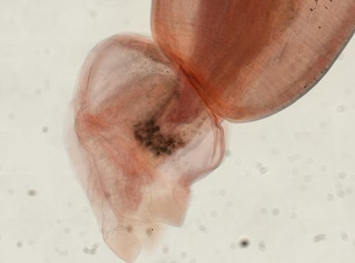 Oligacanthorhynchus microcephalus