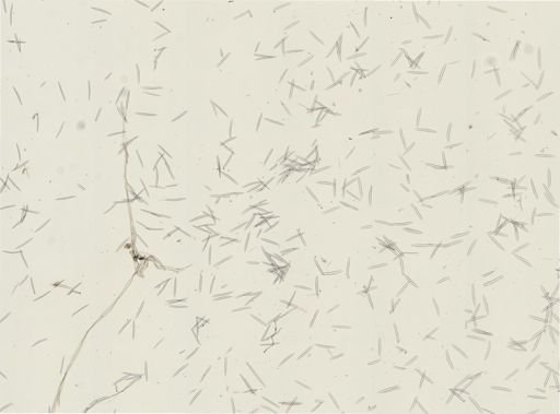 Haliclona oculata