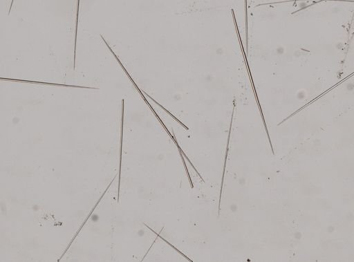 Craniella?