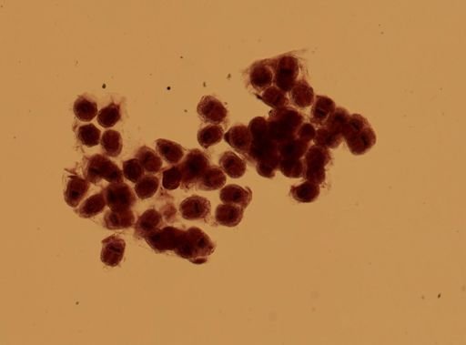 Echinococcus granulosus