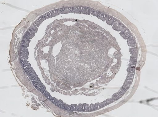 Eimeria meleagrimitis