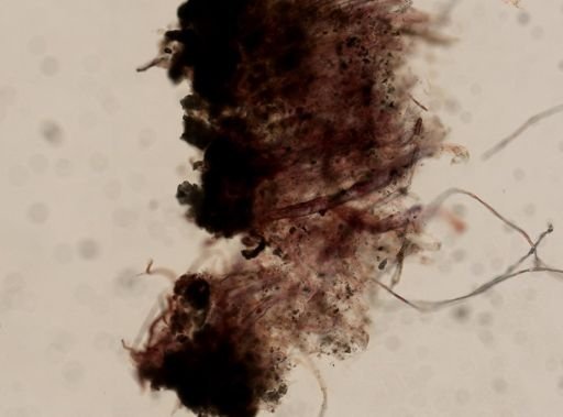 Porifera?