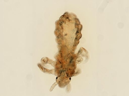 Pediculus humanus