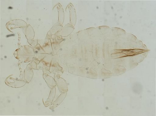 Pediculus humanus
