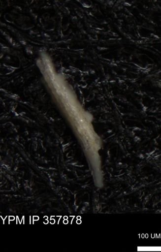 undet. Echinoidea