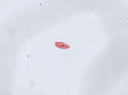 Paramecium aurelia