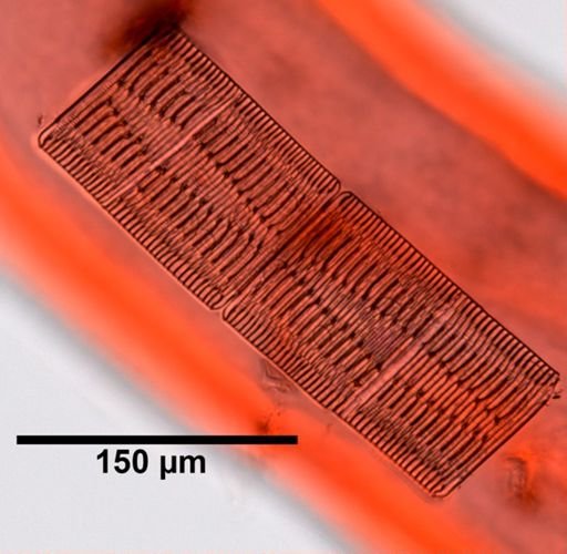 Striatella unipunctata