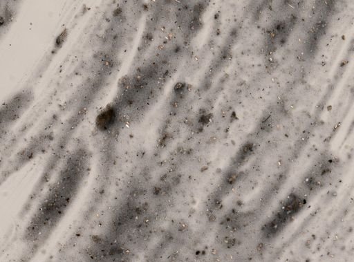 Entamoeba histolytica