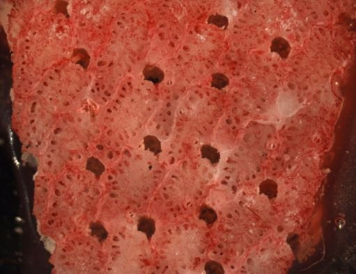 Bryozoa