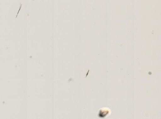 Paramecium