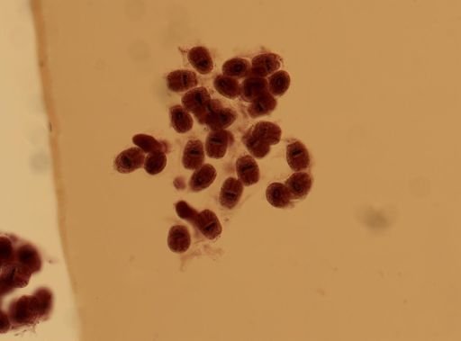 Echinococcus granulosus