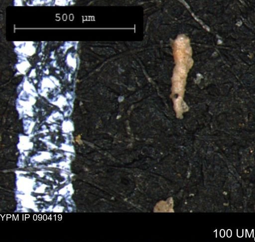 Verneuilina canadensis