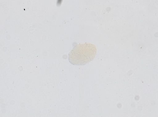 Dipylidium caninum