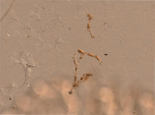 Bryozoa