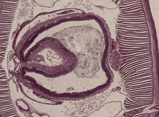 Lumbricus