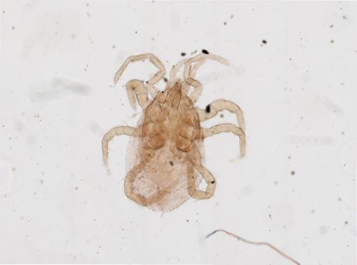 Parasitus coleoptratorum
