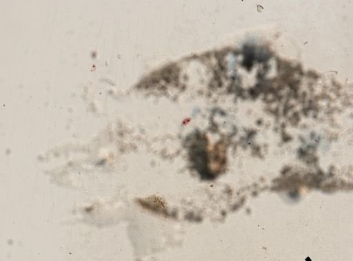 Oxytricha fallax