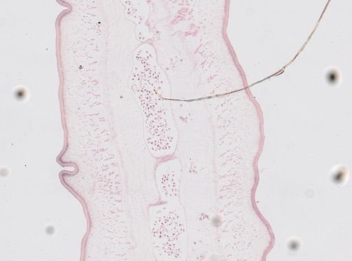Taenia saginata