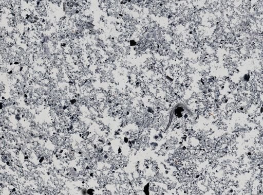 Giardia lamblia