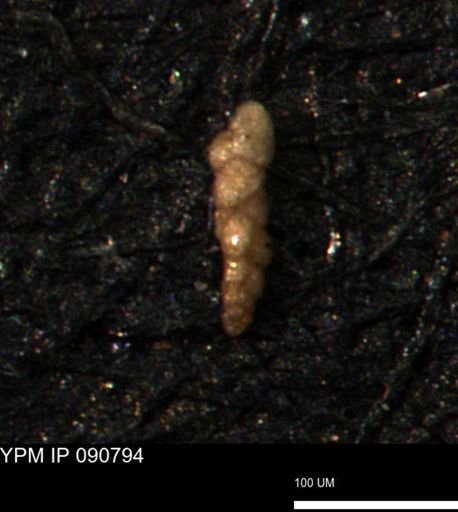 Verneuilina canadensis