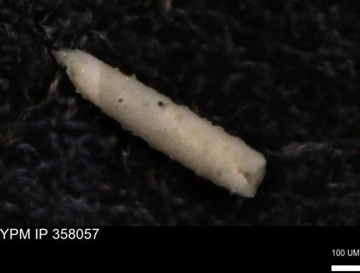 Echinoidea?