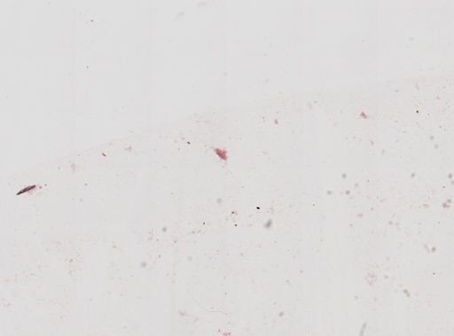 Entamoeba blattae