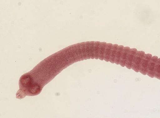 Taenia solium