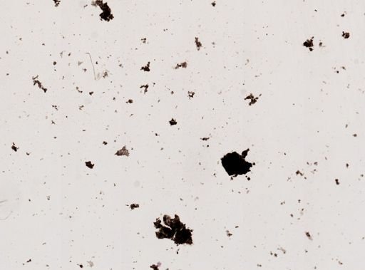 Pleistophora macrozoarcides
