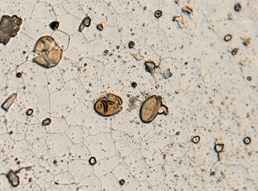 Fasciola hepatica