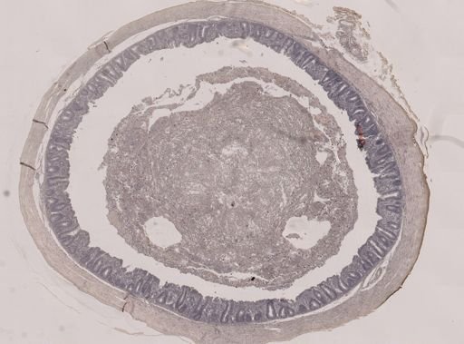 Eimeria meleagrimitis