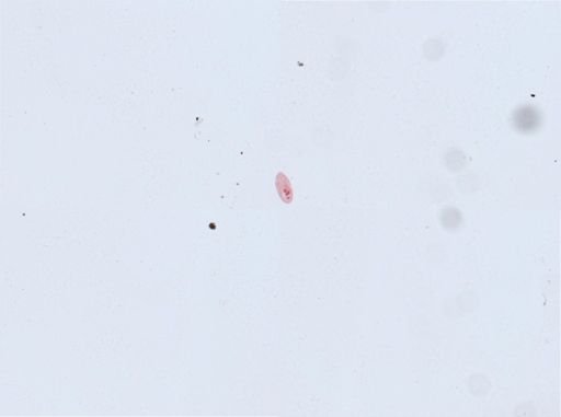 Paramecium aurelia