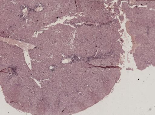 Leishmania donovani