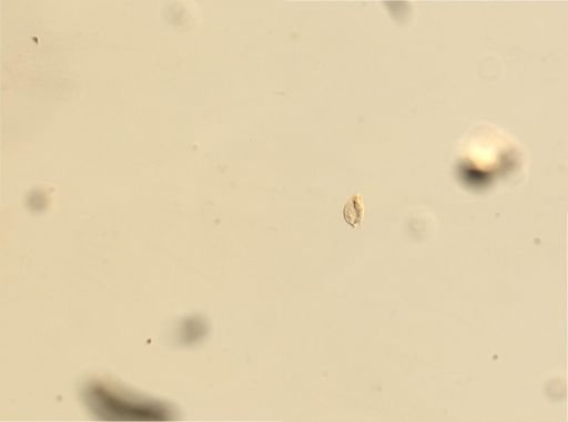Euplotes