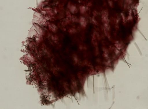 Axinella verrucosa