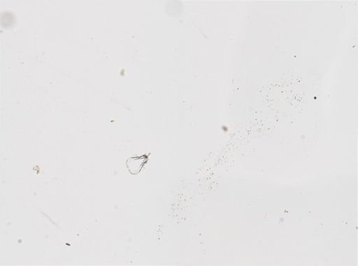 Asplanchna herricki