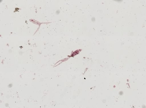 Cercaria gracillima