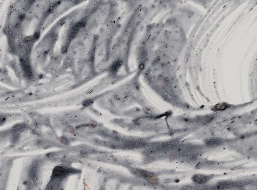 Entamoeba histolytica