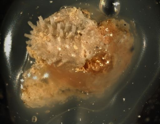 Bryozoa
