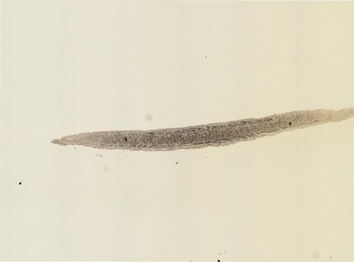 Turbellaria