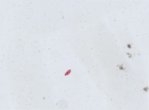 Paramecium