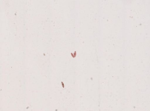 Paramecium caudatum