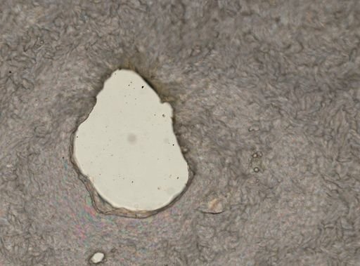 Lecane crepida