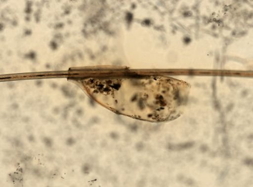 Pediculus humanus